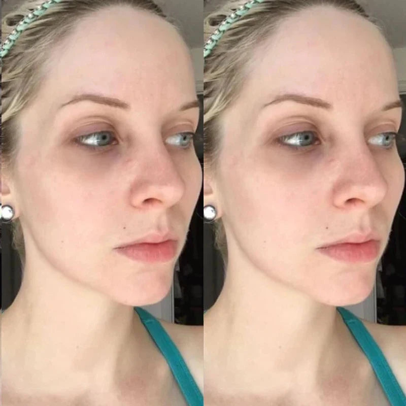 Masque facial coréen à l'acide hyaluronique et au collagène