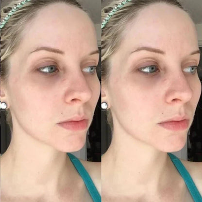 Masque facial coréen à l'acide hyaluronique et au collagène